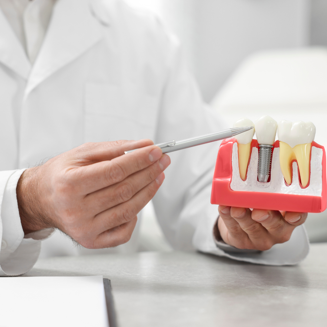 teeth implant nw calgary